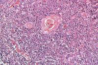 Thymus jeune x100